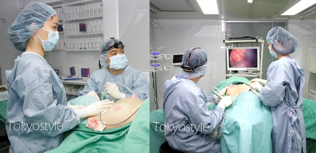 內視鏡隆乳手術-東京風采整形外科診所