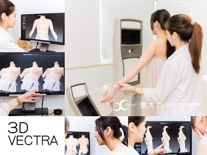 隆乳手術前3D 影像圖檢測-東京風采整形