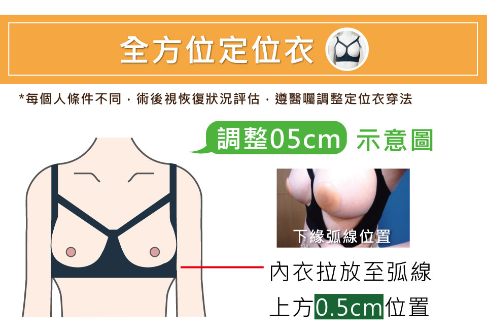 定位衣衛教-隆乳術後衛教-張大力-東京風采整形外科