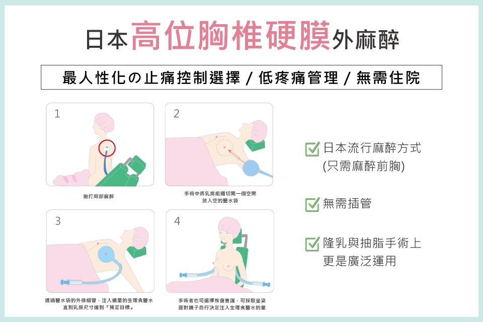 高位胸椎硬膜外麻醉-日本流行-安全隆乳-東京風采整形外科診所