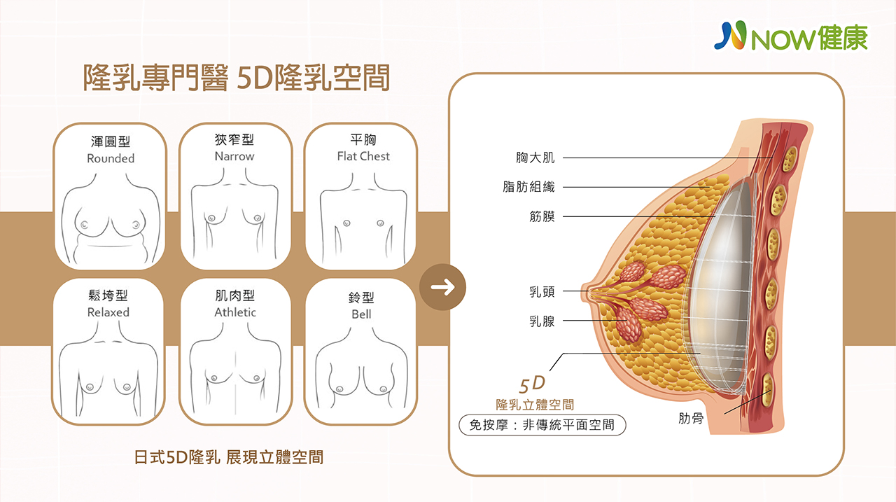 5D隆乳手術免按摩,傳統平面空間升級,掌握乳房延展性空間,隆乳技術,立體空間
